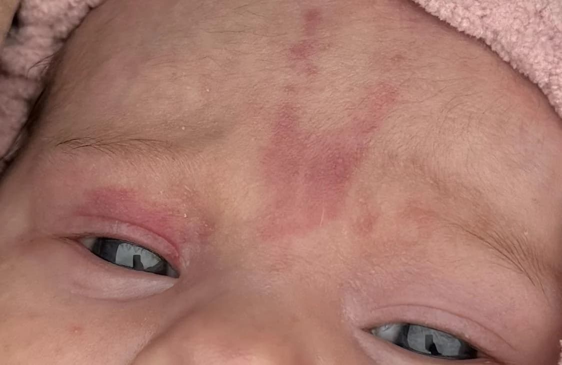 Ten weird things that happen to newborns which are actually super common.